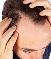 In some cases, the itchiness may be accompanied by flakiness, scaly patches, bumps, and even hair loss. What Is Burning Scalp Syndrome With Pictures