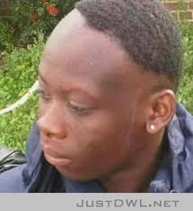 Rajmontaj Bad Hairline Messed Up Hair Epic Fails Funny