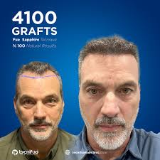 Tecnifue International