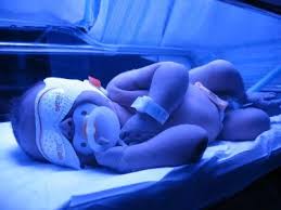 Image result for Phototherapy