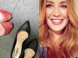 This shocking photo of woman's BLOODIED feet after wearing heels during a  waitressing shift has gone viral