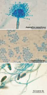 Terreus and aspergillus nidulans) are resistant to amphotericin b 89, 92. Aspergillus Flavus Slide Microscope Control Slide Key Scientific Products