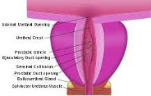 Image result