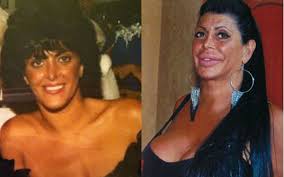 Sections show more follow today plastic surgery might not only help make people. 23 Celebrity Surgery Fails Gallery