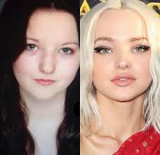Official website of dove cameron emmy award winning actress and singer. Did Dove Cameron Get Surgery Lipstick Alley