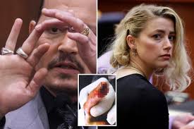 Heard's sister said actress did sever Depp's finger: docs