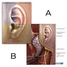 Image result for Ear Nerve Block