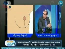 أورام الثدي عملية استئصال تجميلي لأورام الثدي الحميدة والخبيثة Youtube