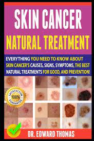 Skin cancer is easiest to treat when it is small and has not yet spread. Skin Cancer Natural Treatment Everything You Need To Know About Skin Cancer S Causes Signs Symptoms The Best Natural Treatments For Good And Prevention Thomas Dr Edward 9781690907367 Books Amazon Ca