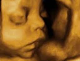 31 semanas de embarazada entra y descubre cómo está el bebé y sus movimientos, así como los síntomas que experimentará la madre. Embarazo Semana 31 Bebe Cabeza Abajo O De Nalgas Natalben