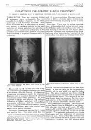 Image result for Intravenous Pyelogram
