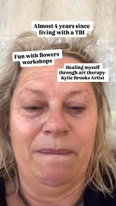 #paulseedsman #concussionawareness #tbiawareness  #theorangebutterflyfoundation