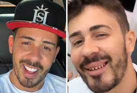 Check spelling or type a new query. Carlinhos Maia Mostra Sorriso Natural Durante Manutencao Nos Dentes Quem Quem News