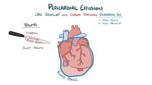 We did not find results for: Beck S Triad What Is It Associated Conditions And More Osmosis