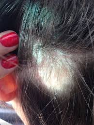 200 Women Claim Wen Hair Care Products Made Their Hair Fall Out Hair Loss Remedies Hair Loss Remedies Women Hair Loss Women