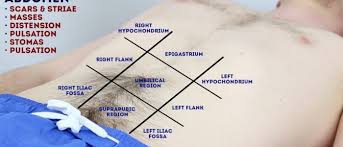 Image result for Shifting Dullness Test