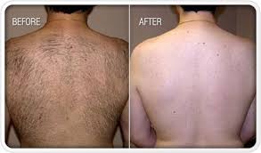 Soothing 1 2 3 4 5 hair removal ingrown hair scrapes soothing all hair types coarse curly normal all deals bogo buy and save giftcard with purchase sale. I Cherish Providing Even Lower Limbs Without Every One Of The Stubble Along With Razor Blade Burn Chest Hair Removal Hair Removal Permanent Hair Removal Cream