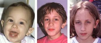 The Clinical Phenotype of the Fragile X Syndrome and Related Disorders