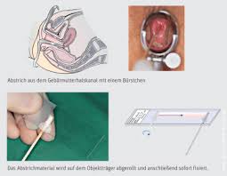 Wann muss ich zum frauenarzt? Der Besuch Beim Frauenarzt