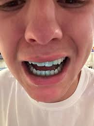 I haven't brushed my teeth in 3 days 😬