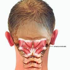 Here is an art file from one of my youtube videos on basic. Anatomy Of Short Neck Muscles Short Neck Muscles With Marked Obliquus Download Scientific Diagram
