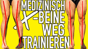 X Beine Wegtrainieren Komplette Erklarung Und Behandlung X Beine Ubungen X Beine Korrigieren Youtube