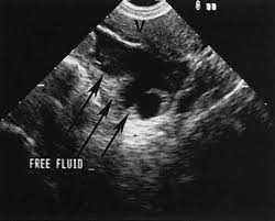 Sonographic Imaging Of The Female Patient With Pelvic Pain/ Bleeding - Ppt  Video Online Download