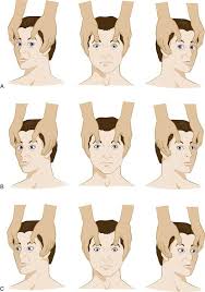 Image result for Oculovestibular Testing