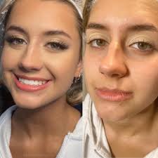 Profile for Beauty by Bayleigh Rose Medical Aesthetician