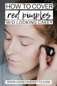 Make Up 101 How To Cover Your Pimples Without Looking Cakey How To Hide Pimples How To Cover Pimples Redness Pimple