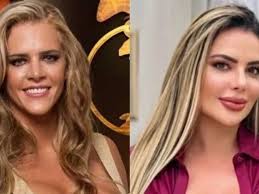 Denise Rocha choca com antes e depois de procedimentos estéticos