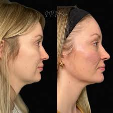 Melissa Tilley, NP (@np_melissa) · Instagram 照片和Reels