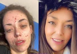 Today, Destiny Fisher stopped by and we were struck by the positive change  in her. She has reached a milestone of one year and six days of sobriety.  She looks great. She