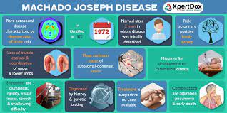 Azorean Machado Joseph Disease Rare Autosomal Disease Characterized By Degeneration Of Brain Cells Disease Machado Joseph