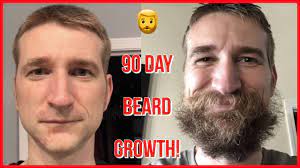 Anagen is the growth phase and can last from several months to up to a year for androgenic hair. 90 Day Beard Growth Time Lapse I Didnt Shave For 3 Months Youtube