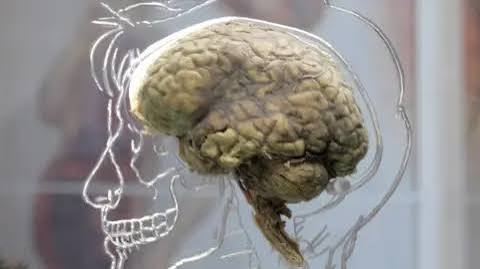 Brain back-up start-up 'will be the death of users'