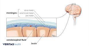 How Meningitis Causes Neck Pain And Stiffness
