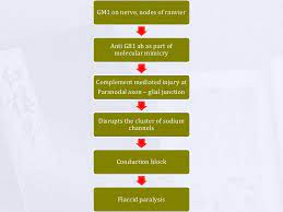 Gupta a, taly ab, srivastava a, murali t. Guillain Barre Syndrome