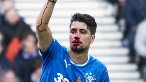 Fabio cardoso has left rangers a season after arriving at ibrox following a mutual termination of his contract. Fun To Watch Him Bleed Spl Opponent Takes Aim At Ex Rangers Sttar Ibrox Noise