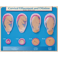 Cervix Examination Simulator Set Childbirth Graphics