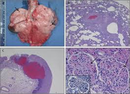 Diese pandemie kam nicht zufällig zustande. A Novel Respiratory Model Of Infection With Monkeypox Virus In Cynomolgus Macaques Journal Of Virology