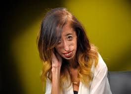 Ever since she was dubbed the world's ugliest woman in a video posted on youtube in 2006, when she was 17, velásquez has spoken out against bullying. Mark J Terrill