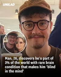 It can be surprising to find out you have this but there's an easy way to  tell 😲