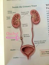 Raw Leafy Greens Friends Or Foe Kidney Stones And The Wisdom Of Moderation Kidney Stone Diet Kidney Stones Kidney