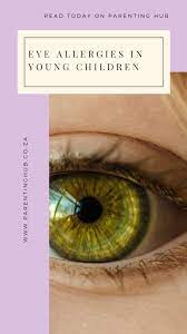 Eye Allergies Are Surprisingly Common In Children In South Africa And Unfortunately This Phenomenon Appears To Be On The In Parenting Kids Allergies Allergies
