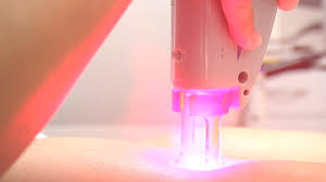 If laser hair removal really works this is the most amazing thing to happen to women since suffrage and birth control. Professional Ipl Laser Hair Removal Everything You Need To Know