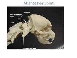 We did not find results for: Atlantoaxial Instability Atlantoaxial Joint Atlantoaxial Joint Atlantoaxial Instability