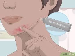 Clogged pores on scalp may lead to folliculitis, which may contributes to hair thinning and eventually, hair loss. Easy Ways To Unclog Hair Follicles 13 Steps With Pictures