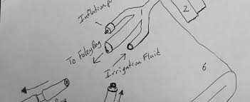 Managing Murphy Drip Fluids Patient There Is Another Way To Live