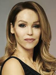 Acid attack victims: Women in Bangladesh tell horrifying stories